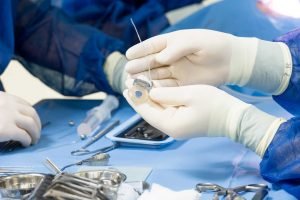 implantes-cocleares